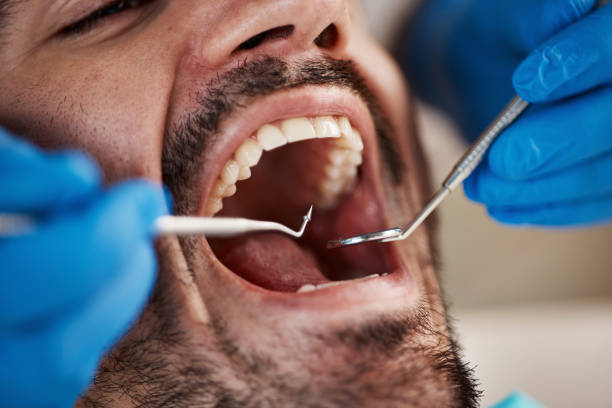 Best Broken or Cracked Tooth Emergency Dentist in Normal, IL